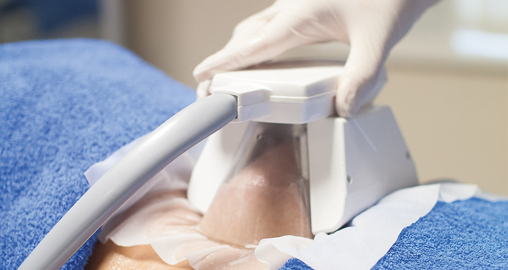 How Fat Freezing and HIFU Work Together? 2 Multiple Areas in One Session HIFU and Fat Freezing Nottingham