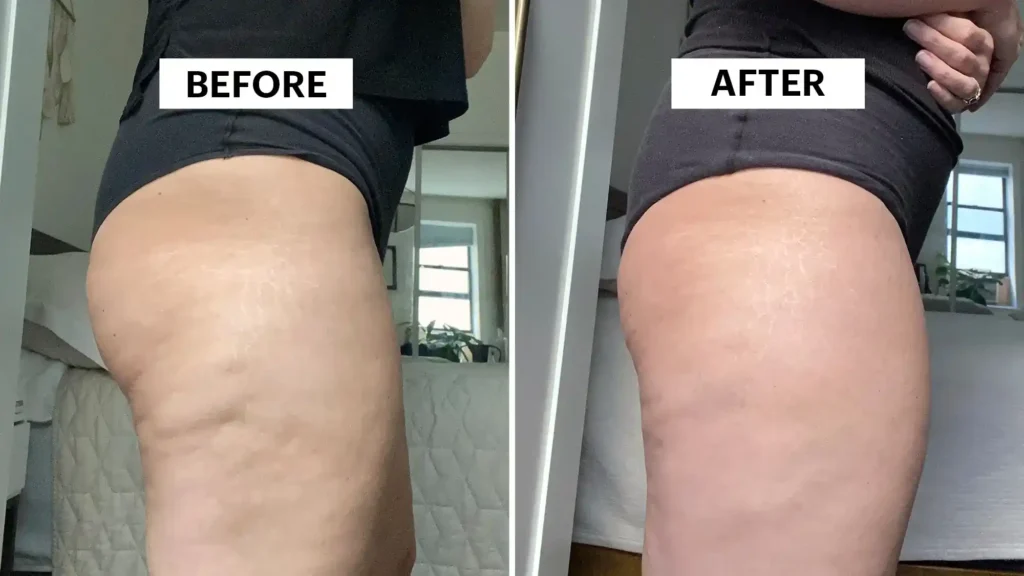 Sculpting Your Bum: Can Toning Exercises Really Reduce Cellulite? 1 Do Toning Exercise Nottingham Really Tackle Cellulite?