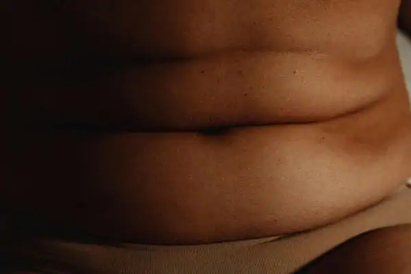 The Hidden Connection: How Stress Shapes Your Fitness and Body Composition 3 image of what stress can do on the stomach area and how Lipo 360 Nottingham can help to change your body shape.